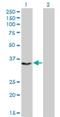 Enp antibody, H00064946-M01, Novus Biologicals, Western Blot image 