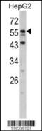 Protein downstream neighbor of Son antibody, 62-329, ProSci, Western Blot image 