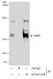 Ubiquitin Specific Peptidase 7 antibody, GTX631109, GeneTex, Immunoprecipitation image 
