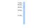 MFNG O-Fucosylpeptide 3-Beta-N-Acetylglucosaminyltransferase antibody, 30-426, ProSci, Western Blot image 