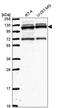RNA Binding Motif Protein 15 antibody, PA5-65572, Invitrogen Antibodies, Western Blot image 