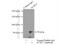 Acyl-CoA Synthetase Long Chain Family Member 5 antibody, 15708-1-AP, Proteintech Group, Immunoprecipitation image 