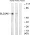 Solute Carrier Family 5 Member 6 antibody, TA314828, Origene, Western Blot image 