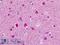 Cullin 1 antibody, LS-B9302, Lifespan Biosciences, Immunohistochemistry paraffin image 