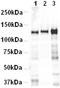 Cadherin 2 antibody, ab16505, Abcam, Western Blot image 