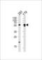 Aldehyde Dehydrogenase 1 Family Member A3 antibody, LS-C97464, Lifespan Biosciences, Western Blot image 