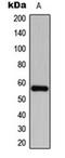 Collagen Type IV Alpha 1 Chain antibody, orb6174, Biorbyt, Western Blot image 