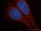 Glutamate Dehydrogenase 2 antibody, 14462-1-AP, Proteintech Group, Immunofluorescence image 