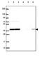 Protein Phosphatase 1 Catalytic Subunit Beta antibody, NBP2-49446, Novus Biologicals, Western Blot image 