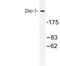 Death Inducer-Obliterator 1 antibody, LS-C177043, Lifespan Biosciences, Western Blot image 