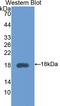 Hexosaminidase Subunit Beta antibody, LS-C294502, Lifespan Biosciences, Western Blot image 