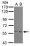 ADP Ribosylation Factor GTPase Activating Protein 3 antibody, LS-C155439, Lifespan Biosciences, Western Blot image 