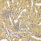 Ubiquitin Conjugating Enzyme E2 Z antibody, A7225, ABclonal Technology, Immunohistochemistry paraffin image 