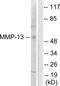 Matrix Metallopeptidase 13 antibody, LS-C118520, Lifespan Biosciences, Western Blot image 