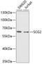 Secretogranin II antibody, GTX54665, GeneTex, Western Blot image 