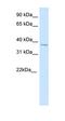 Spi-1 Proto-Oncogene antibody, orb324746, Biorbyt, Western Blot image 