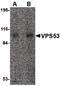 VPS53 Subunit Of GARP Complex antibody, PA5-20549, Invitrogen Antibodies, Western Blot image 