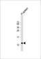 Pro-Platelet Basic Protein antibody, 62-985, ProSci, Western Blot image 