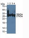 Carbonic anhydrase C antibody, LS-C299249, Lifespan Biosciences, Western Blot image 