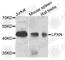 Leupaxin antibody, A9803, ABclonal Technology, Western Blot image 