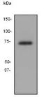 Matrix Metallopeptidase 8 antibody, ab81286, Abcam, Western Blot image 