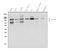 TNF Receptor Superfamily Member 21 antibody, A04348-2, Boster Biological Technology, Western Blot image 