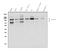 Tumor necrosis factor receptor superfamily member 21 antibody, A04348-2, Boster Biological Technology, Western Blot image 