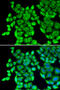 Eukaryotic Translation Elongation Factor 1 Delta antibody, 18-678, ProSci, Immunofluorescence image 