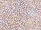 SPANX Family Member N4 antibody, 204506-T08, Sino Biological, Immunohistochemistry frozen image 