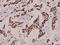 RNA Polymerase II Subunit A antibody, A01029S1619, Boster Biological Technology, Immunohistochemistry paraffin image 