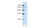 Cleavage And Polyadenylation Specific Factor 6 antibody, ARP40697_T100, Aviva Systems Biology, Western Blot image 