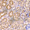 Cytochrome P450 Family 51 Subfamily A Member 1 antibody, A6252, ABclonal Technology, Immunohistochemistry paraffin image 