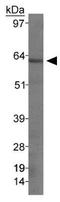 Somatostatin Receptor 1 antibody, GTX30184, GeneTex, Western Blot image 