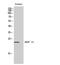 AKAP14 antibody, GTX34363, GeneTex, Western Blot image 