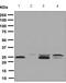 Catechol-O-Methyltransferase antibody, ab126618, Abcam, Western Blot image 