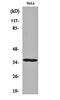 Casein Kinase 1 Alpha 1 antibody, orb160239, Biorbyt, Western Blot image 