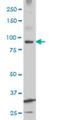 Kinase suppressor of Ras 2 antibody, H00283455-M07, Novus Biologicals, Western Blot image 