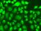 tRNA-splicing endonuclease subunit Sen2 antibody, GTX32940, GeneTex, Immunofluorescence image 
