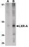 Nuclear Receptor Subfamily 1 Group H Member 3 antibody, PA5-20880, Invitrogen Antibodies, Western Blot image 