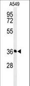 Proteasomal ATPase Associated Factor 1 antibody, LS-C163330, Lifespan Biosciences, Western Blot image 