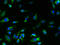 Transmembrane Protein 61 antibody, A61438-100, Epigentek, Immunofluorescence image 