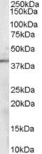 Sorbitol Dehydrogenase antibody, PA5-18333, Invitrogen Antibodies, Western Blot image 