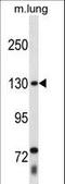 Thyroid Hormone Receptor Associated Protein 3 antibody, LS-C161862, Lifespan Biosciences, Western Blot image 