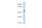 Nuclear Receptor Subfamily 2 Group E Member 1 antibody, 27-861, ProSci, Enzyme Linked Immunosorbent Assay image 