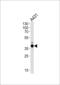 Actin Related Protein 2/3 Complex Subunit 1B antibody, 63-628, ProSci, Western Blot image 