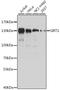 Sirtuin 1 antibody, LS-C746926, Lifespan Biosciences, Western Blot image 