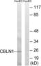 Cerebellin 1 Precursor antibody, LS-C119839, Lifespan Biosciences, Western Blot image 
