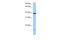 Heparan Sulfate-Glucosamine 3-Sulfotransferase 5 antibody, A11166, Boster Biological Technology, Western Blot image 