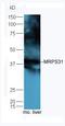 Lysophosphatidylcholine Acyltransferase 2 antibody, orb185130, Biorbyt, Western Blot image 