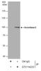 Aconitase 2 antibody, GTX114233, GeneTex, Immunoprecipitation image 